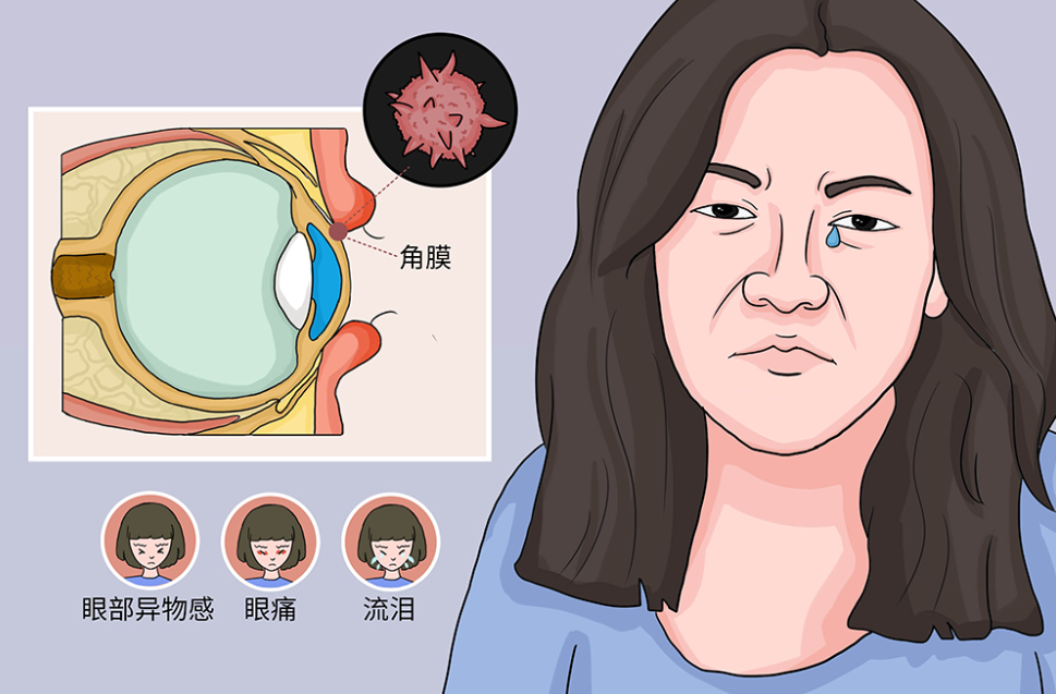 配图1.png